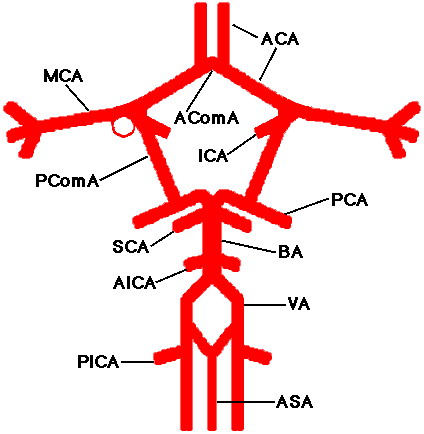 Mca Angiogram